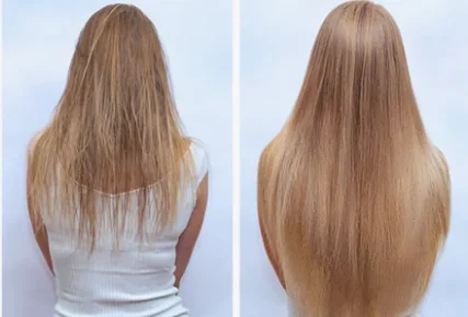Antes y después del tratamiento con Biotina Premium